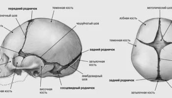 Устранение краниостеноза. Случай из практики специалистов НПЦ