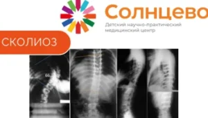 Cколиоз 4-й степени. Случай из практики